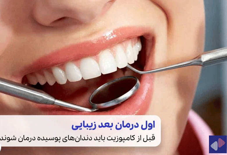 تصویر ابزار دندانپزشکی در دهان بیمار