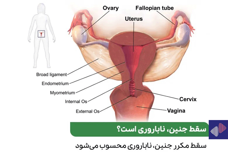 تصویر گرافیکی از رحم